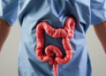 Rectal Cancer Survivors Follow Three Distinct Bowel Symptom Paths After Sphincter-Preserving Surgery