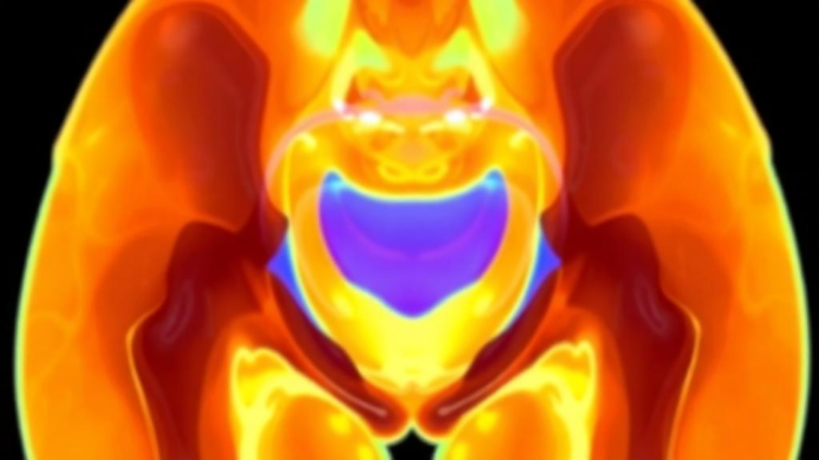 Dynamic MRI Reveals How the Young Pelvic Floor Moves From Rest to Strain to Squeeze
