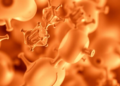 One in five on dolutegravir HIV therapy in East Africa shows hyperglycemia