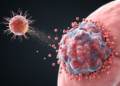 Engineered Dendritic Cell Vaccine Draws Immune Cells Into Lung Tumors but Falls Short of Shrinkage
