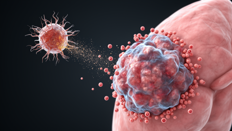 Engineered Dendritic Cell Vaccine Draws Immune Cells Into Lung Tumors but Falls Short of Shrinkage