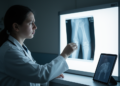 ChatGPT Falls Short at Spotting Children's Elbow Fractures on X-rays