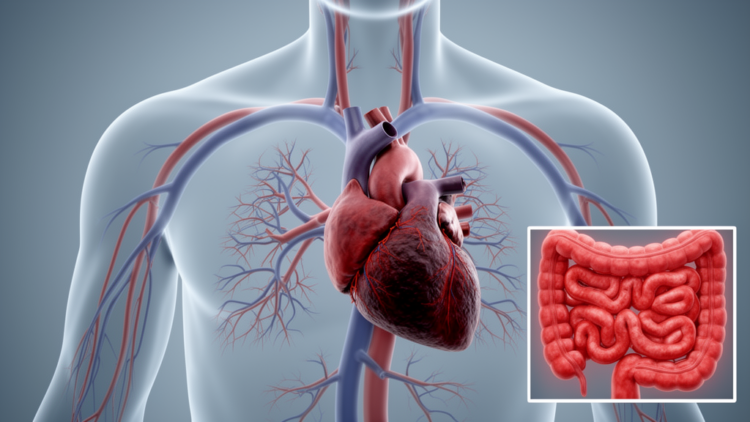 When Risk Factors Stack: Steroids, Colitis, and a Massive Pulmonary Embolism