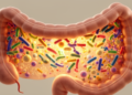 How the Aging Microbiome Shapes Health in Later Life