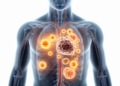 Not All Immune Checkpoint Inhibitor Side Effects Are Equal for Survival