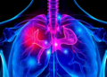 New Biomarkers and AI Aim to Cut Unnecessary Prostate Biopsies Before the Needle