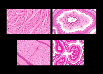 AI Reads Skin Biopsies: Deep Learning Tells Four Look-Alike Inflammatory Diseases Apart