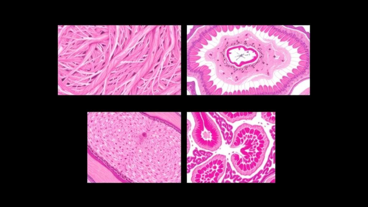AI Reads Skin Biopsies: Deep Learning Tells Four Look-Alike Inflammatory Diseases Apart