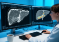AI Reads Liver Scans to Predict Which Colorectal Cancer Patients Will Respond to Chemotherapy