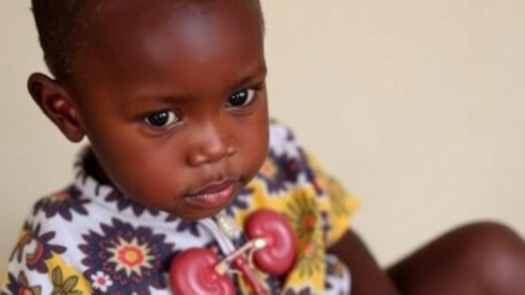 In Senegal, Nearly One in Five Children With Kidney Birth Defects Progresses to Advanced Chronic Kidney Disease