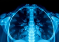 Bismuth-Filled Silicone Nanocomposites Deliver Real-Time Readout of Diagnostic X-Ray Doses
