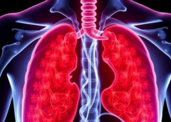 Immunochemotherapy Before Surgery Cuts Recurrence Risk in Esophageal Cancer, Meta-Analysis Finds