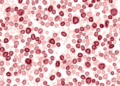 Old-Fashioned Mitotic Count May Outperform Ki67 in Hormone Receptor-Positive Breast Cancer