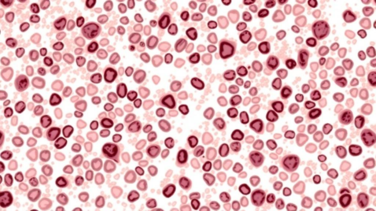 Old-Fashioned Mitotic Count May Outperform Ki67 in Hormone Receptor-Positive Breast Cancer