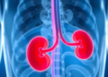 Kidney Damage Emerges as Hidden Complication in Beta-Thalassemia Survivors