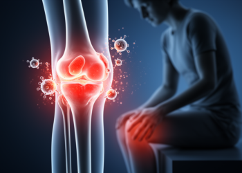 Psychological Stress Triggers Arthritis Flares Through an IL-6-Dependent Pathway