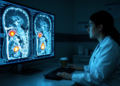 Spleen Activity on Pre-Treatment PET Scans Predicts Survival in Gastric Cancer Patients Receiving Immunotherapy