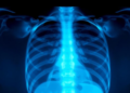 AI Learns to Check Its Own X-Ray Reports by Searching Past Cases Before Writing