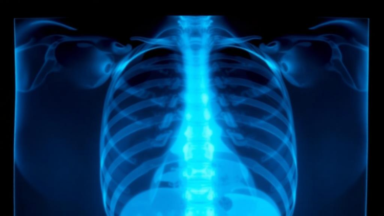 AI Learns to Check Its Own X-Ray Reports by Searching Past Cases Before Writing