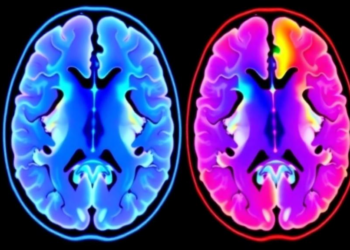 MRI Radiomics Model Predicts IL13Rα2 Expression and Survival in Glioblastoma