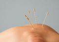 Acupuncture Shows Hints of Benefit for Vascular Dementia, but Evidence Falls Short