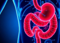 Apatinib-based neoadjuvant regimens show promise in resectable gastric cancer meta-analysis