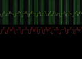 Hidden Rhythms in Paralyzed Gait Revealed by New Spatiotemporal Analysis