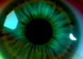 Multimodal AI Classifies Herpes Simplex Keratitis Subtypes Across Three Eye Centers