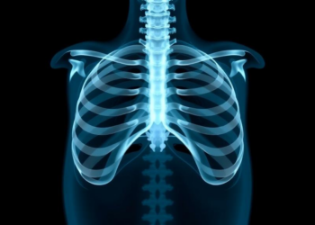 Older Women and Recurrent TB Face Higher Risk of Bone and Joint Tuberculosis, Study Finds