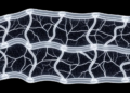 Chitosan-Layered PLGA Scaffold Fails to Boost Vessel Density in Rabbit Urethroplasty Study