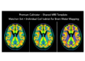 Shared MRI Template Matches Individual Coil Calibration for Brain Water Mapping