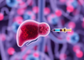Turning liver tumor ablation into a vaccine: the immune logic behind a new HCC strategy