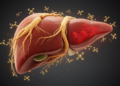 Novel Ginseng-Derived Compound Shields the Liver From Acetaminophen Overdose by Damping HIF1α-Driven Glycolysis