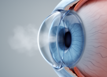 New Volumetric Measure Captures Corneal Deflection in Three Dimensions Under Air-Puff Loading