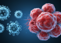 Vaccine-Strain Measles and Mumps Viruses Team Up to Kill Colorectal Cancer Cells