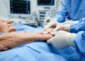Distal Radial Artery Access Goes on Trial in Older Surgical Patients