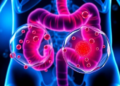 Fat-Fuelled Tumours: How Lipid Droplets Drive Colorectal Cancer Aggression