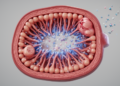 How Infection Signals Push Kidney Filter Cells Into Leaks, Damage, and Cell Death