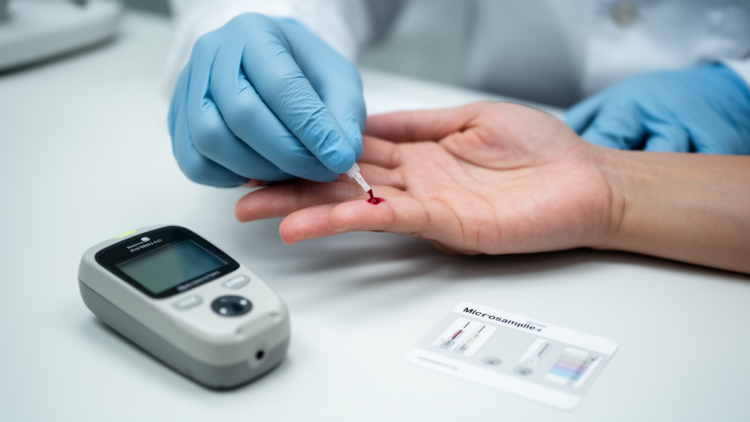 Finger-prick blood test for Alzheimer's biomarkers works for some proteins but fails on pTau217
