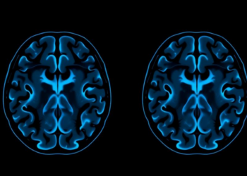 AI Reads Routine MRI Scans to Predict Brain Invasion in Meningiomas Before Surgery
