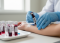 Two Blood Proteins Could Let Doctors Stage Alzheimer's Disease With a Simple Draw