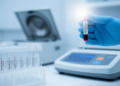 Ten plasma proteins flag ALS with near-perfect accuracy in blood test