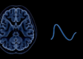 Novel CTNNB1 missense variant identified in child with spastic diplegia and visual defects