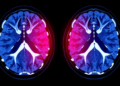 Penn AI model detects hidden disease signals in CT scans
