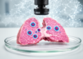 Machine learning links immune-cell measures to resected lung cancer prognosis