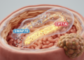 SWAP70 promotes liver cancer growth through CPT1A-dependent fatty acid oxidation