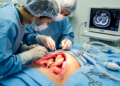 CT Suspicion of Pancreatic Duct Injury Confirmed at Operation
