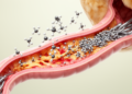 Baicalin partly eases APEC-induced ileal injury in broiler chickens