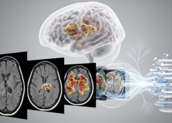 UAC-Net links brain-tumor typing and MRI segmentation in one model