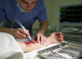 Nomogram predicts vascular crisis after free flap surgery